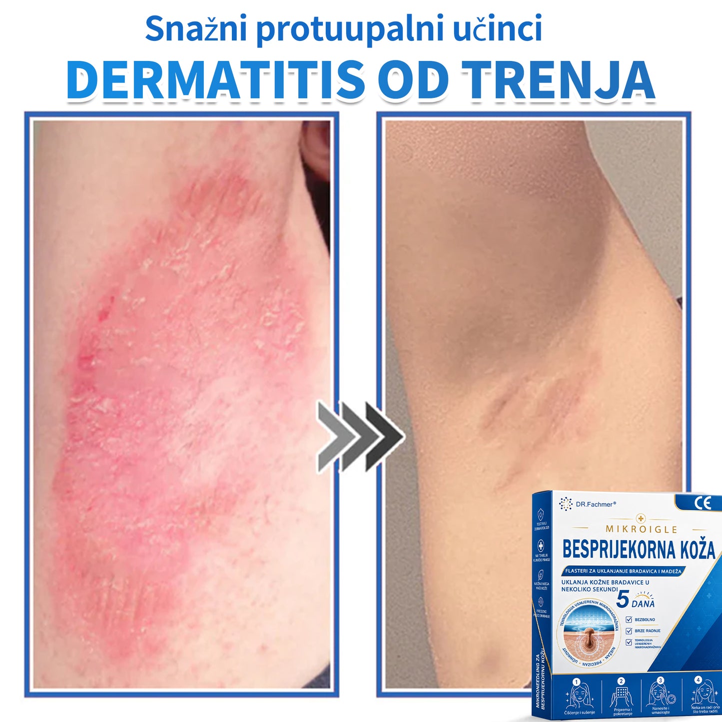 ✅ DR.Fachmer®❤️ 2-u-1 flaster s mikroiglicama i hidrokoloidom | Uklanjanje podignutih madeža, akni, ravnih bradavica i kožnih izraslina | Ublažava bore, ožiljke i mrlje | Nevidljivi flasteri za prištiće za lice i tijelo