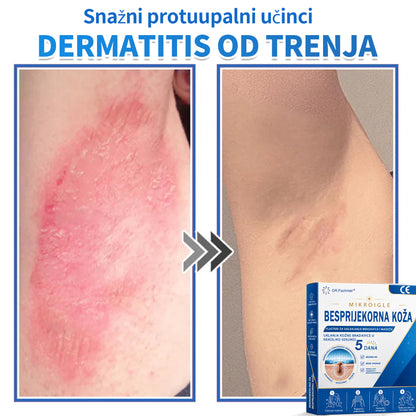 ✅ DR.Fachmer®❤️ 2-u-1 flaster s mikroiglicama i hidrokoloidom | Uklanjanje podignutih madeža, akni, ravnih bradavica i kožnih izraslina | Ublažava bore, ožiljke i mrlje | Nevidljivi flasteri za prištiće za lice i tijelo