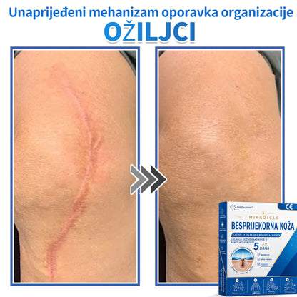 ✅ DR.Fachmer®❤️ 2-u-1 flaster s mikroiglicama i hidrokoloidom | Uklanjanje podignutih madeža, akni, ravnih bradavica i kožnih izraslina | Ublažava bore, ožiljke i mrlje | Nevidljivi flasteri za prištiće za lice i tijelo