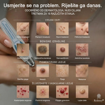 ✅✨𝐒𝐥𝐮ž𝐛𝐞𝐧𝐚 𝐭𝐫𝐠𝐨𝐯𝐢𝐧𝐚 𝐫𝐨𝐛𝐧𝐞 𝐦𝐚𝐫𝐤𝐞  Rolimey®   𝟕-𝐝𝐧𝐞𝐯𝐧𝐢 𝐨𝐝𝐬𝐭𝐫𝐚𝐧𝐣𝐢𝐯𝐚č 𝐛𝐫𝐚𝐝𝐚𝐯𝐢𝐜𝐚 𝐢 𝐦𝐫𝐥𝐣𝐚(Nula boli, nula 𝐒𝐜𝐚𝒓𝒔 Rollerball) 🎗️