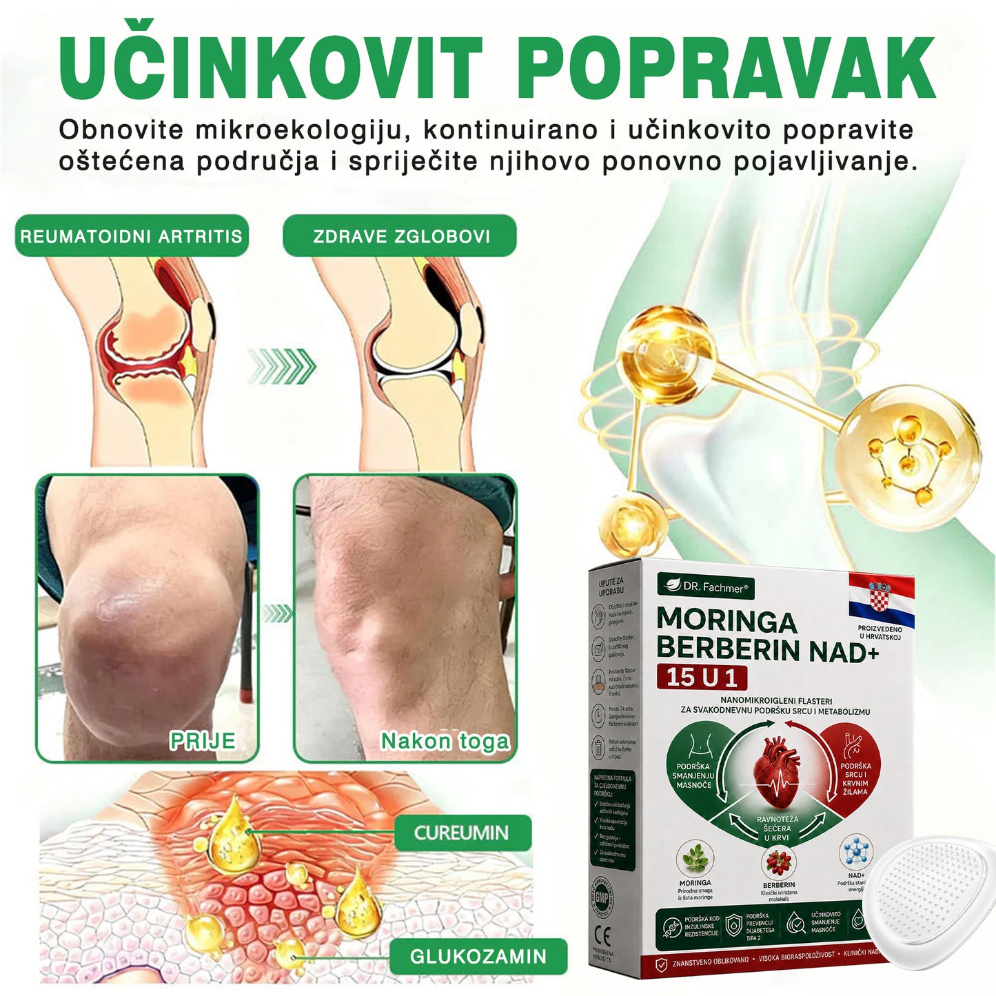 💡DR.Fachmer® Moringa Berberin NAD+ 15-u-1 Nano-mikroigleni Flaster | Nova generacija njege tijela s naprednom nano formulom💡