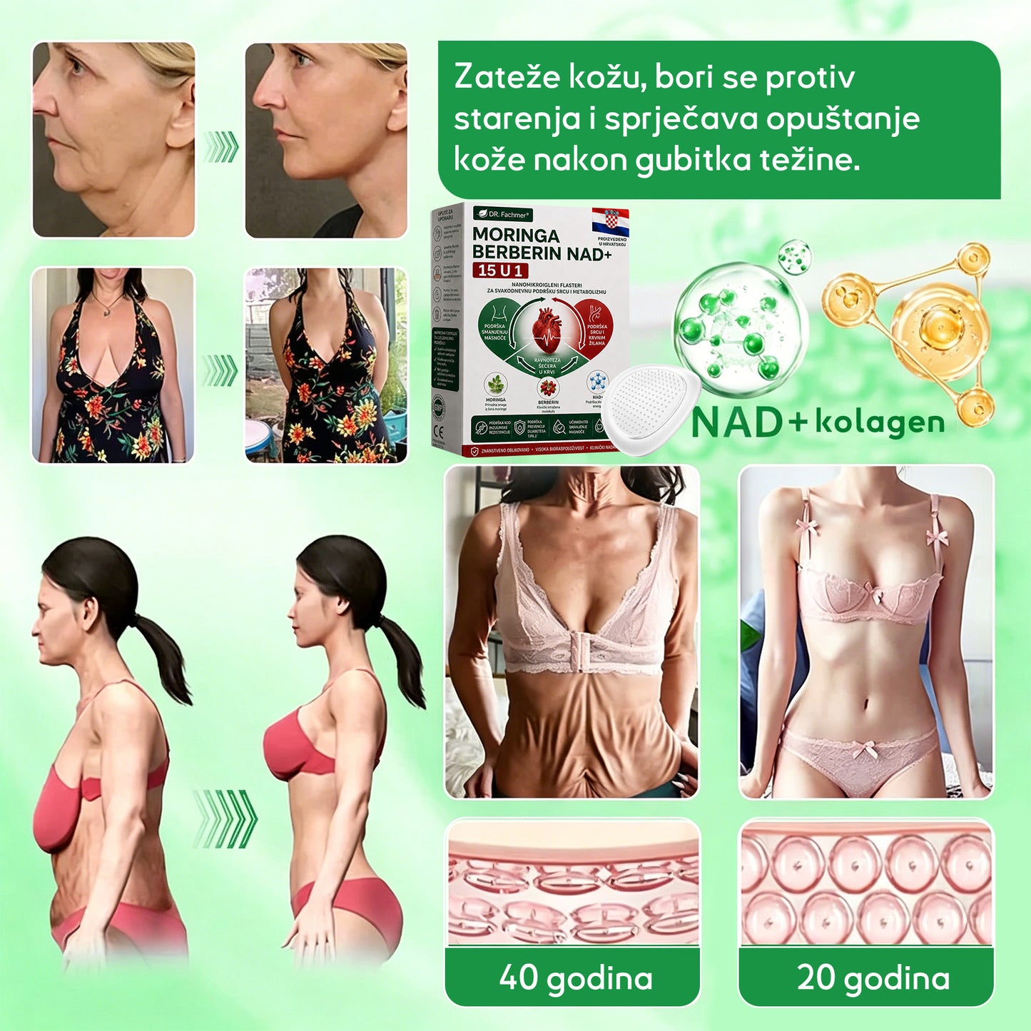 💡DR.Fachmer® Moringa Berberin NAD+ 15-u-1 Nano-mikroigleni Flaster | Nova generacija njege tijela s naprednom nano formulom💡