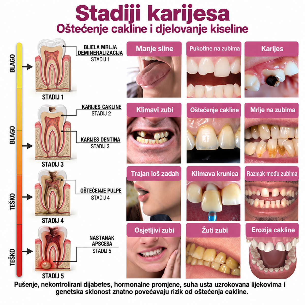 Rolimey® DenPerm – gel za obnovu zubne cakline i sanaciju karijesa