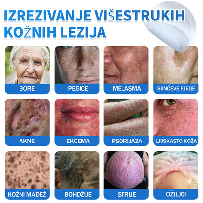 ✅ DR.Fachmer®❤️ 2-u-1 flaster s mikroiglicama i hidrokoloidom | Uklanjanje podignutih madeža, akni, ravnih bradavica i kožnih izraslina | Ublažava bore, ožiljke i mrlje | Nevidljivi flasteri za prištiće za lice i tijelo