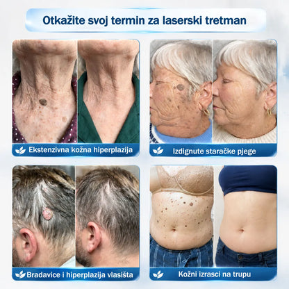 ✅✨𝐒𝐥𝐮ž𝐛𝐞𝐧𝐚 𝐭𝐫𝐠𝐨𝐯𝐢𝐧𝐚 𝐫𝐨𝐛𝐧𝐞 𝐦𝐚𝐫𝐤𝐞  Rolimey®   𝟕-𝐝𝐧𝐞𝐯𝐧𝐢 𝐨𝐝𝐬𝐭𝐫𝐚𝐧𝐣𝐢𝐯𝐚č 𝐛𝐫𝐚𝐝𝐚𝐯𝐢𝐜𝐚 𝐢 𝐦𝐫𝐥𝐣𝐚(Nula boli, nula 𝐒𝐜𝐚𝒓𝒔 Rollerball) 🎗️