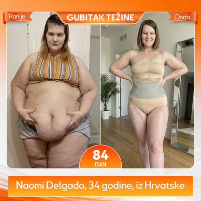 🎈 Službena trgovina brenda | 👙GFOUK® 2026 MORINGA I BERBERIN 4-u-1 MIKROČESTIČNA TEHNOLOGIJA OBLIKOVANJA I KRATKE HLAČE ZA SAGORIJEVANJE MASTI