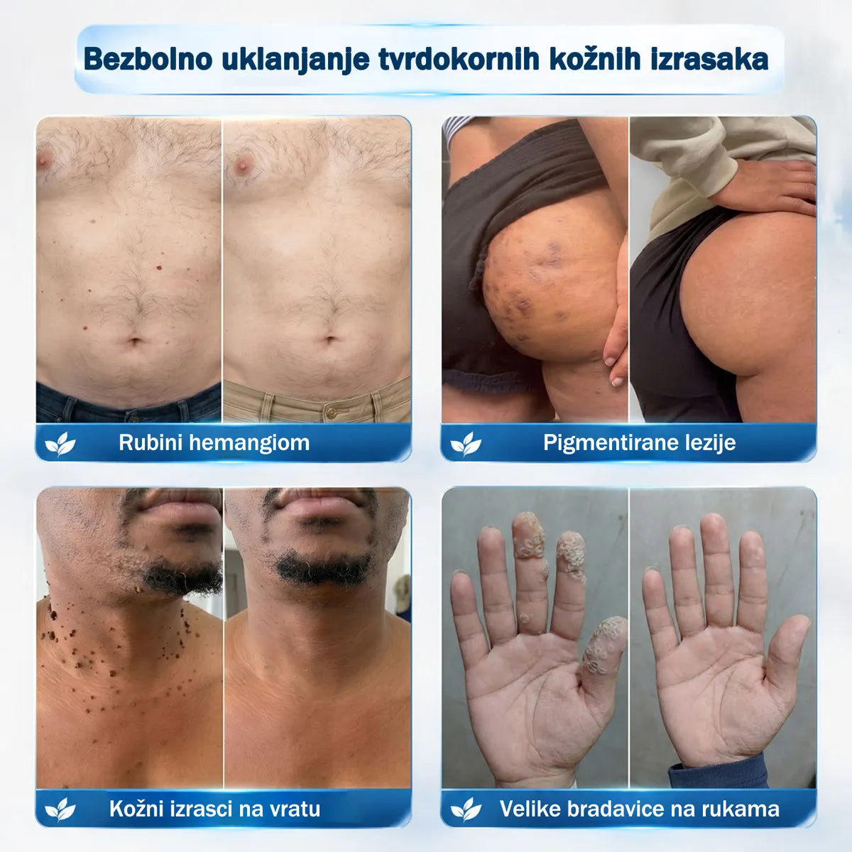 ✅✨𝐒𝐥𝐮ž𝐛𝐞𝐧𝐚 𝐭𝐫𝐠𝐨𝐯𝐢𝐧𝐚 𝐫𝐨𝐛𝐧𝐞 𝐦𝐚𝐫𝐤𝐞  Rolimey®   𝟕-𝐝𝐧𝐞𝐯𝐧𝐢 𝐨𝐝𝐬𝐭𝐫𝐚𝐧𝐣𝐢𝐯𝐚č 𝐛𝐫𝐚𝐝𝐚𝐯𝐢𝐜𝐚 𝐢 𝐦𝐫𝐥𝐣𝐚(Nula boli, nula 𝐒𝐜𝐚𝒓𝒔 Rollerball) 🎗️