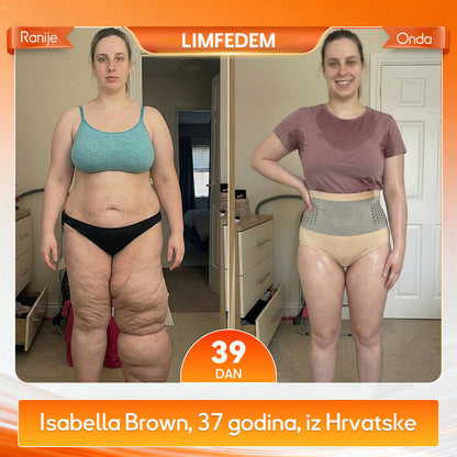 ⏳⏳Službena trgovina brenda | 👙GFOUK® 2026 MORINGA I BERBERIN 4-u-1 MIKROČESTIČNA TEHNOLOGIJA OBLIKOVANJA I KRATKE HLAČE ZA SAGORIJEVANJE MASTI