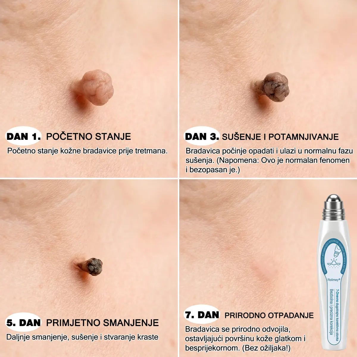 ✅✨𝐒𝐥𝐮ž𝐛𝐞𝐧𝐚 𝐭𝐫𝐠𝐨𝐯𝐢𝐧𝐚 𝐫𝐨𝐛𝐧𝐞 𝐦𝐚𝐫𝐤𝐞  Rolimey®   𝟕-𝐝𝐧𝐞𝐯𝐧𝐢 𝐨𝐝𝐬𝐭𝐫𝐚𝐧𝐣𝐢𝐯𝐚č 𝐛𝐫𝐚𝐝𝐚𝐯𝐢𝐜𝐚 𝐢 𝐦𝐫𝐥𝐣𝐚(Nula boli, nula 𝐒𝐜𝐚𝒓𝒔 Rollerball) 🎗️