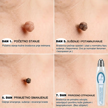✅✨𝐒𝐥𝐮ž𝐛𝐞𝐧𝐚 𝐭𝐫𝐠𝐨𝐯𝐢𝐧𝐚 𝐫𝐨𝐛𝐧𝐞 𝐦𝐚𝐫𝐤𝐞  Rolimey®   𝟕-𝐝𝐧𝐞𝐯𝐧𝐢 𝐨𝐝𝐬𝐭𝐫𝐚𝐧𝐣𝐢𝐯𝐚č 𝐛𝐫𝐚𝐝𝐚𝐯𝐢𝐜𝐚 𝐢 𝐦𝐫𝐥𝐣𝐚(Nula boli, nula 𝐒𝐜𝐚𝒓𝒔 Rollerball) 🎗️