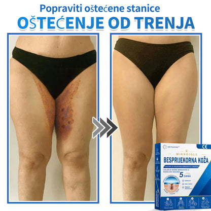 ✅ DR.Fachmer®❤️ 2-u-1 flaster s mikroiglicama i hidrokoloidom | Uklanjanje podignutih madeža, akni, ravnih bradavica i kožnih izraslina | Ublažava bore, ožiljke i mrlje | Nevidljivi flasteri za prištiće za lice i tijelo