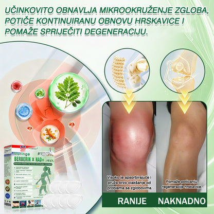 💡GFOUK® Moringa Berberin NAD+ 15-u-1 Nano-mikroigleni Flaster | Nova generacija njege tijela s naprednom nano formulom 💡