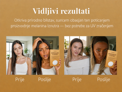 🪐🪐Uštedite do 85% na Trilumia® flasterima za preplanuli ten bez sunca ☀️ Zlatno brončani sjaj bez UV zraka ✨ Prirodan ten do 14 dana